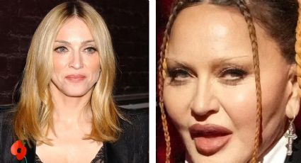 ¿Qué le pasó al rostro de Madonna?; su cara divide opiniones