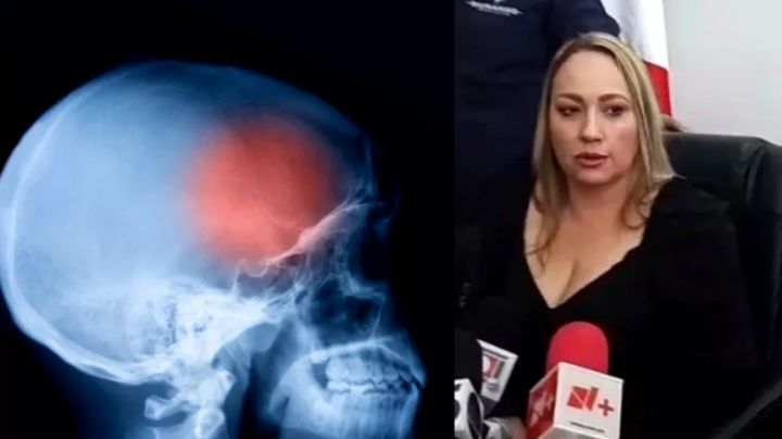 Arrestan a anestesiólogo por casos de meningitis en Durango