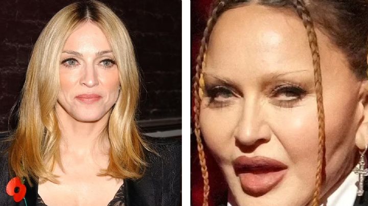¿Qué le pasó al rostro de Madonna?; su cara divide opiniones