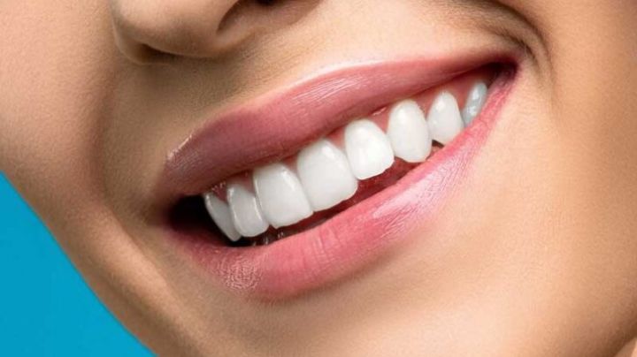 ¿Quieres una sonrisa alineada sin brackets?, te decimos cómo