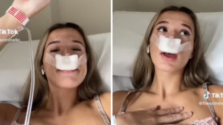Chica se hace rinoplastia para heredar nariz bonita a sus hijos; se burlan en redes