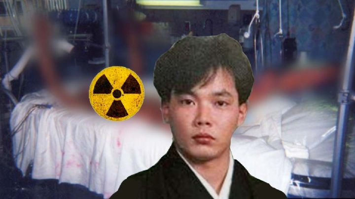 Hombre muere deshebrado: su agonía duró 83 días | FOTOS