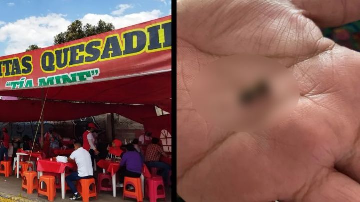 Va a comer barbacoa y se rompe un diente con un peligroso objeto en la comida