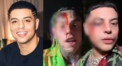 "Golpean" a Eduin Caz junto a rapero Tekashi69; ¿qué pasó? | VIDEO