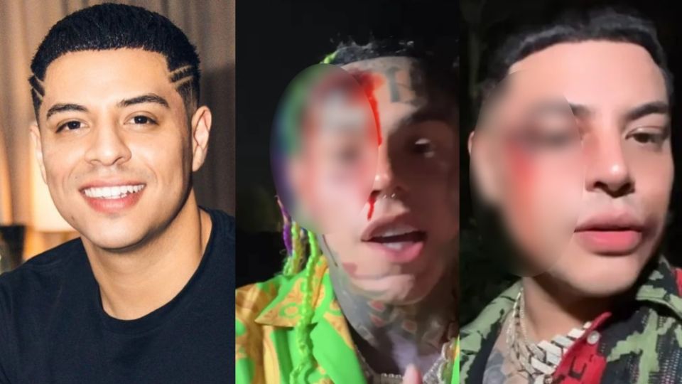 Ambos artistas se mostraron con un golpe en el rostro, del cual aparentemente sangran mientras trabajaban en una colaboración musical juntos