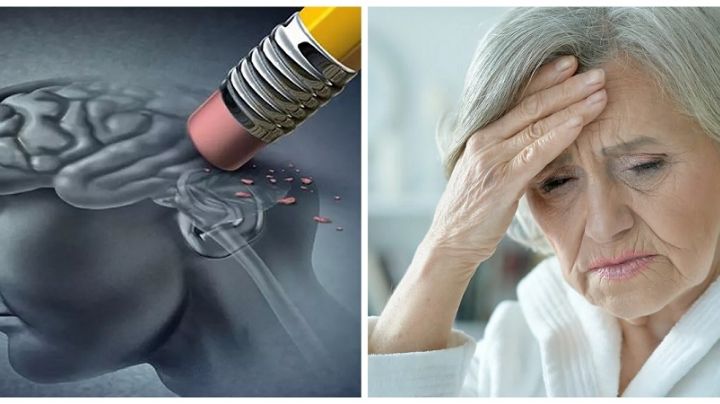 Alzheimer: la muerte silenciosa; por estos motivos podrías padecerla en el futuro