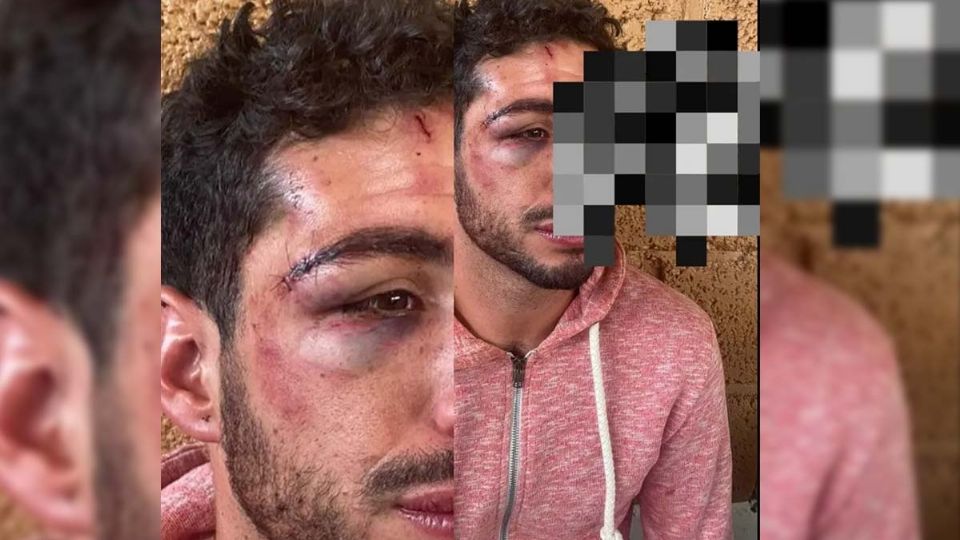 Jovenes son golpeados en el bar Cosmo