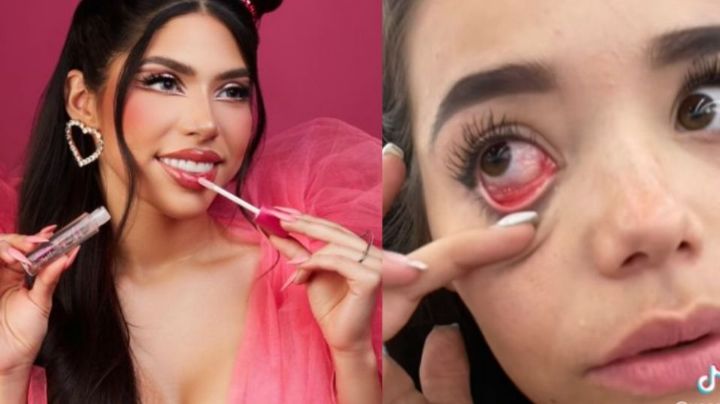 Joven denuncia que maquillaje de Yeri Mua le causa alergia; influencer responde
