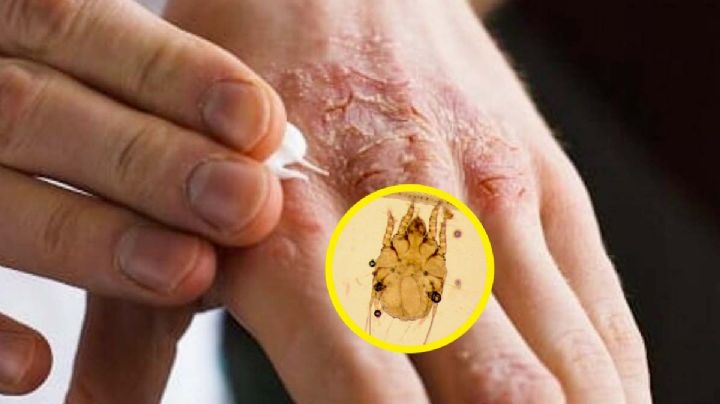 6 insectos chupa sangre de los que te debes cuidar; están en tu entorno