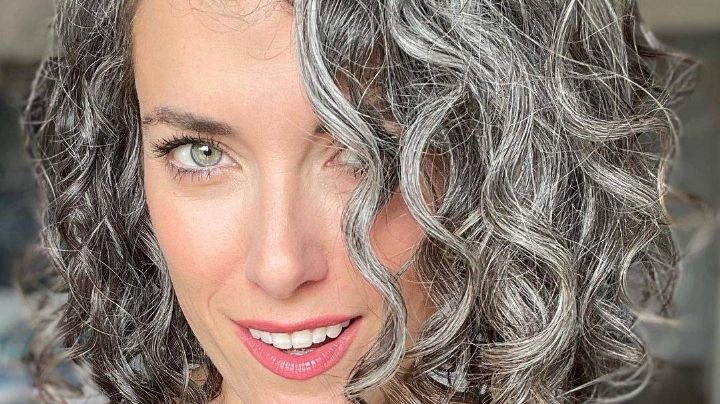 Canas, ¿por cuáles razones pueden surgir en jóvenes?