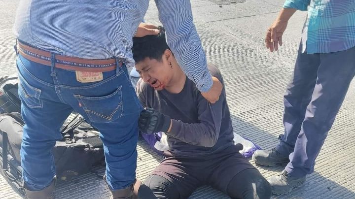 Motociclista llega vomitando sangre al hospital tras ser embestido por vehículo fantasma