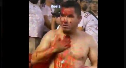 Lamentable: bronca entre hinchas mexicanos deja a un apuñalado en el pecho | VIDEO