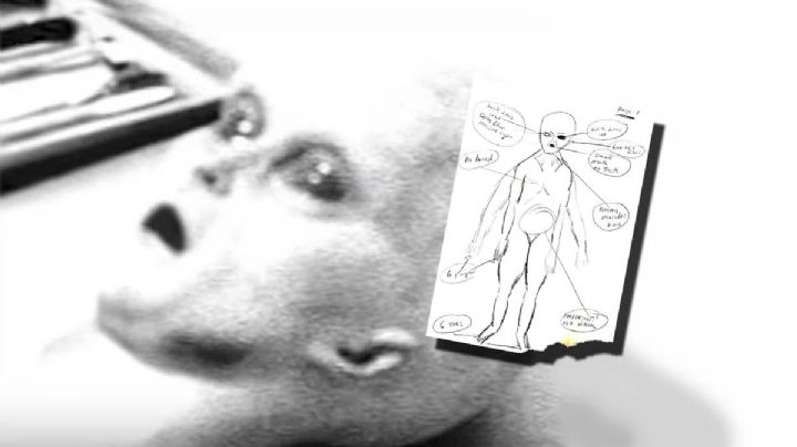 La 'autopsia a un alien': el video que paralizó al mundo