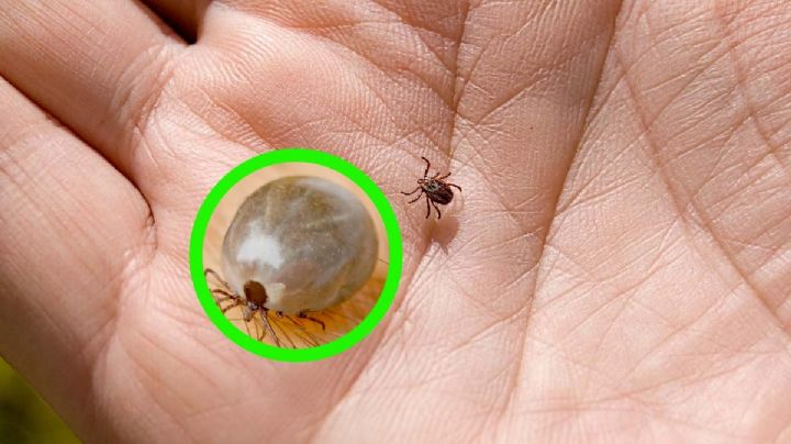 ¿Te picó una garrapata? Esta es la forma correcta de quitarla