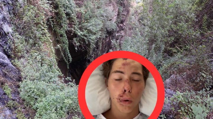 Famoso influencer cae 20 metros de altura sobre roca volcánica en Hawái | VIDEO