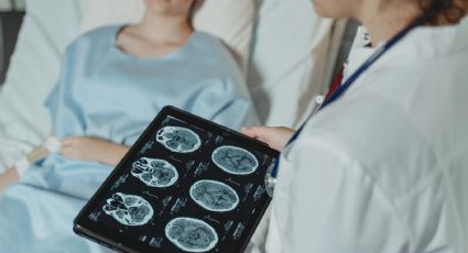 Médicos extraen un gusano parásito del cerebro de una mujer; salió vivo y retorciéndose