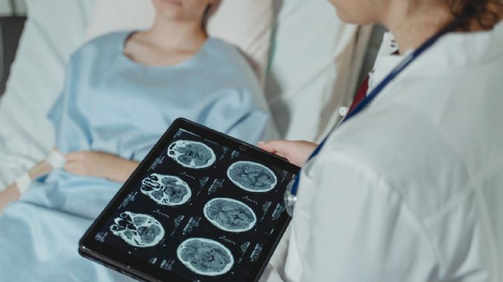 Médicos extraen un gusano parásito del cerebro de una mujer; salió vivo y retorciéndose