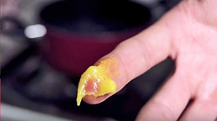 ¿Funciona untarse mostaza sobre las quemaduras?, aquí te decimos