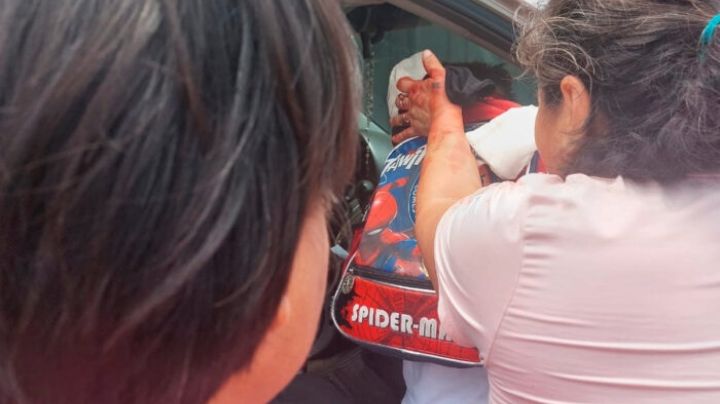 Pitbull le desfigura el rostro a niño de 5 años; todavía siente las mordidas: papá | VIDEOS