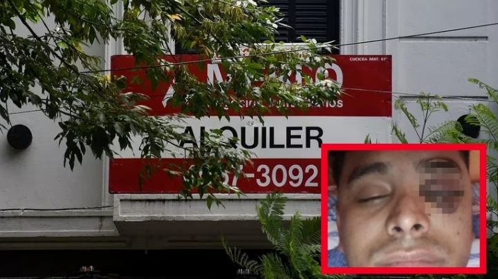 Se atrasa con la renta 2 semanas y casero lo deja sin un ojo; pide justicia