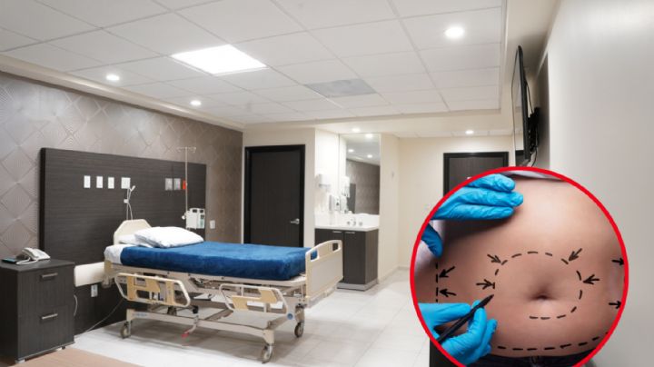 Mujer se hace una liposucción y termina grave en Monterrey; se debate entre la vida y la muerte