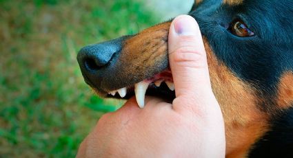 Perros destrozan y matan a joven de 21 años; eran 5 animales en el ataque