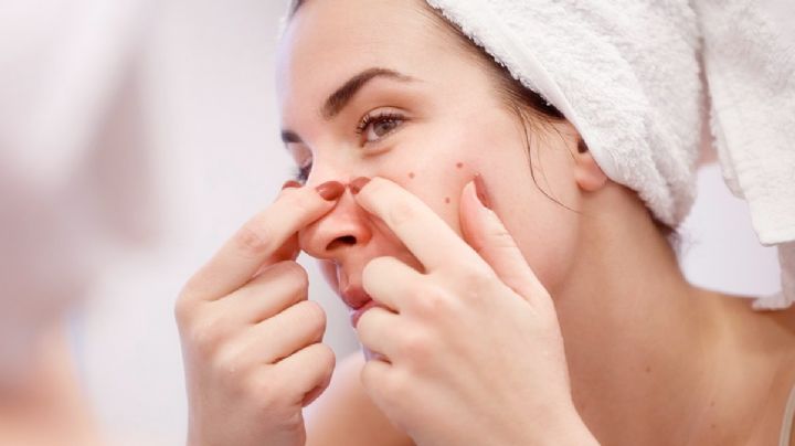 Los nuevos métodos para curar el acné con gran efectividad