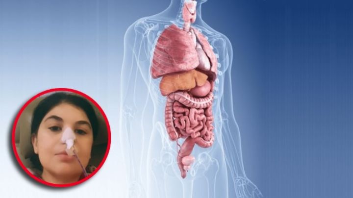 Acude al médico por dolor estomacal y le descubren 5 órganos de más