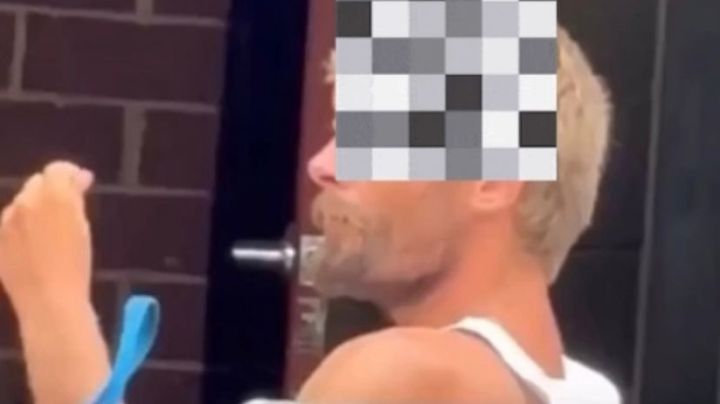 FUERTES IMÁGENES | Captan a hombre con el cerebro expuesto en plena calle; ¿qué ocurrió?