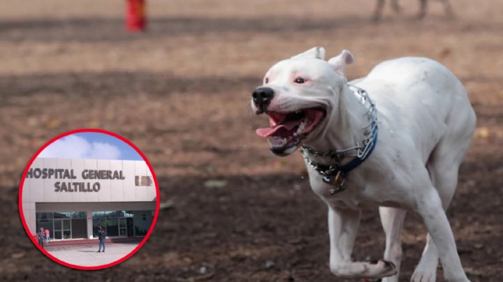 Pitbull le arranca parte de la pierna a un hombre; usaron al perro para asaltarlo