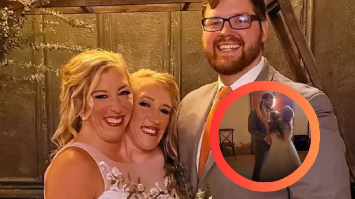 Abby Hensel: ¿cómo es la vida íntima de la gemela siamesa tras su boda?