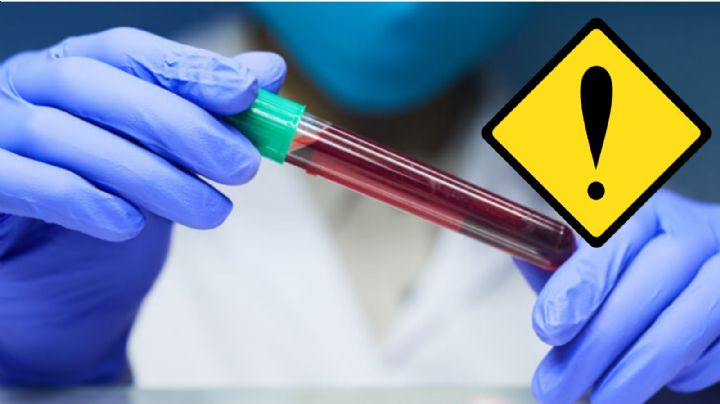 Tamaulipas: detectan 300 nuevos casos de VIH en este 2024