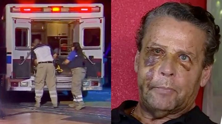 La Casa de los Famosos: ¿Adame fue sacado en ambulancia del reality? | VIDEO