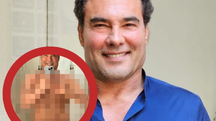 'Mis patas de pollo': Eduardo Yáñez recibe insultos tras mostrarse en bikini | FOTO