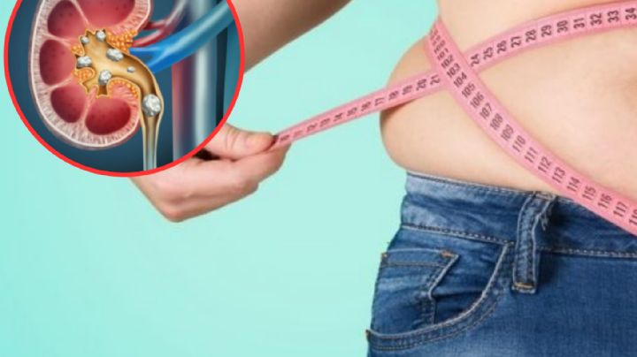 Alerta en México por incremento de enfermedades renales en el país