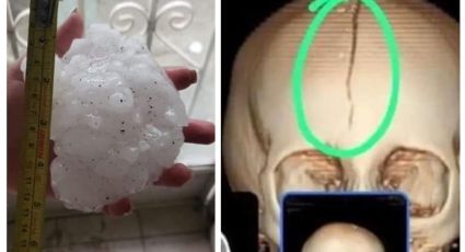 Granizo fractura cabeza a niña en Coahuila; está muy grave