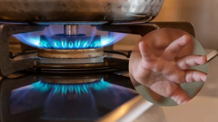 Bebito se quema la cara al caerle comida caliente; su mamá lo descuidó