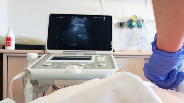 Mujer llevó más de 30 años en su vientre un feto calcificado: se lo extirpan y fallece