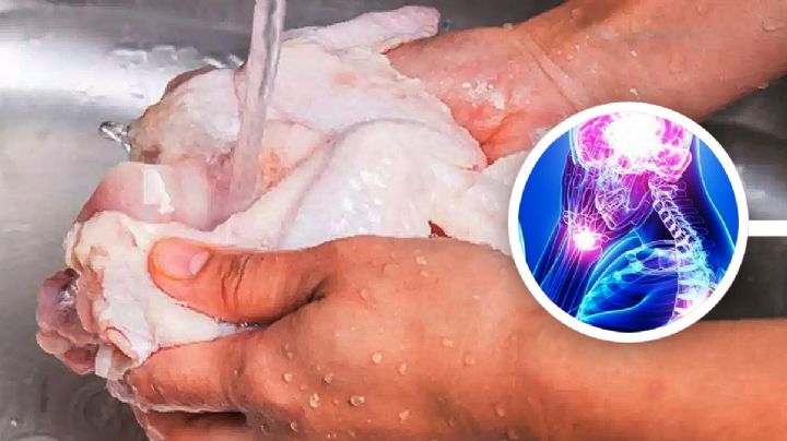 ¿Qué relación tiene el lavado de pollo y el síndrome de Guillain-Barré?