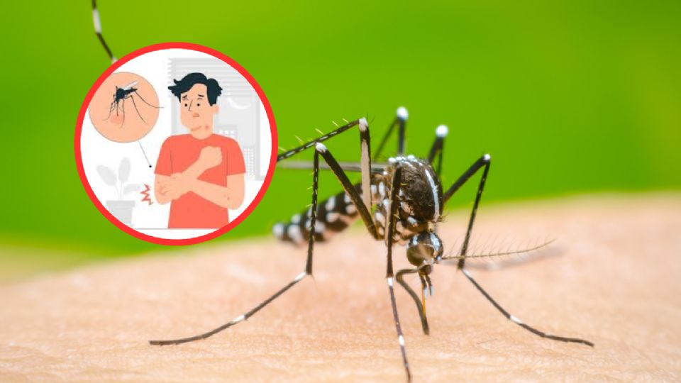 Dengue