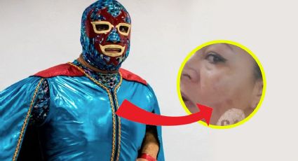 Luchador Dos Caras: acusado por quemaduras con ácido a mujer