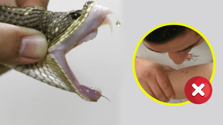 Si una víbora te muerde, estos son los primeros auxilios ante el ataque