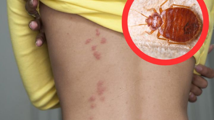 Conoce a la ciudad de Texas que está infestada con chinches; no te gustará pasar la noche