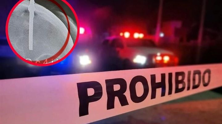 Le entierran varilla en la cabeza por orinarse en la calle y sobrevive de milagro