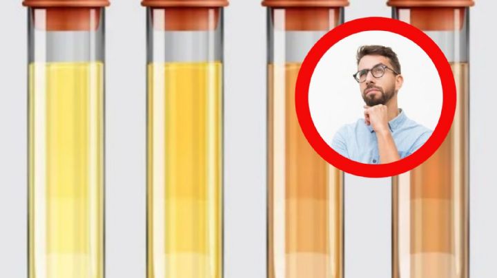 ¿Qué indica el color de tu orina y cuándo deberías preocuparte?