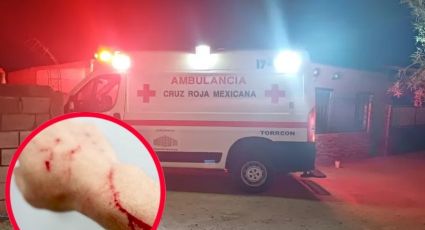 Joven sufre amputación de su brazo tras discutir con su novia