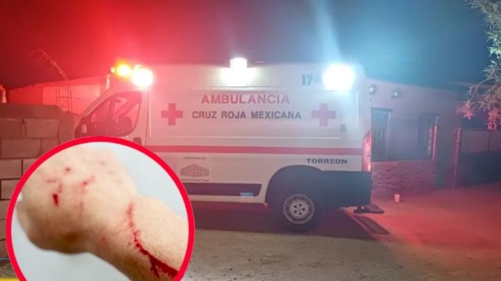 Joven sufre amputación de su brazo tras discutir con su novia