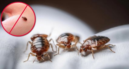 Temporada de chinches: esto debes ponerte en el cuerpo para evitar que te piquen