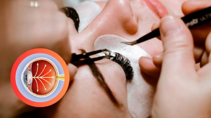 Entre el glamour y el peligro: los riesgos de salud al usar extensiones de pestañas