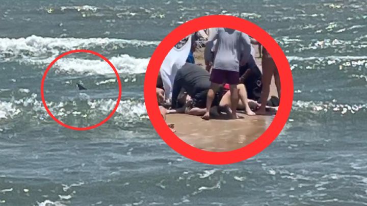 Tiburón ataca gravemente a mujer en playa de la Isla del Padre | FUERTES IMÁGENES